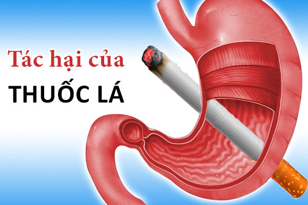 Bàng hoàng trước tác hại của thuốc lá trên dạ dày – Bỏ ngay kẻo muộn